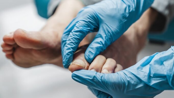 কিভাবে ভাল জন্য খসখসে পায়ের নখ থেকে পরিত্রাণ পেতে... যেহেতু কিভাবে ভাল জন্য খসখসে পায়ের নখ থেকে পরিত্রাণ পেতে... যেহেতু শীর্ষস্থানীয় গবেষকরা সহজ, 'বিপ্লবী' নতুন চিকিত্সা প্রকাশ করেছেন
| BanglaKagaj.in